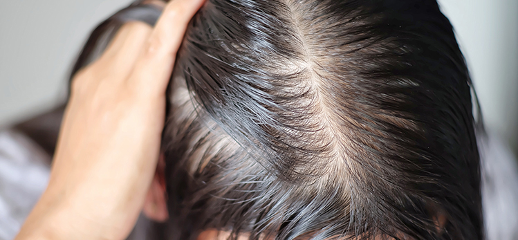 Why Do Hair Losses Thicken?